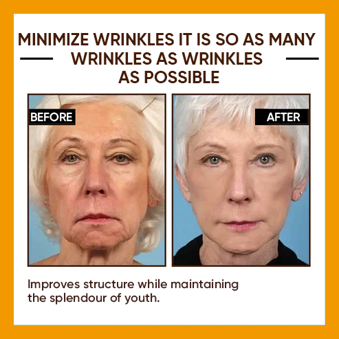 🔥Full refund if no effect after use🔥2026, Exclusive premium Suiiao COMPLEX technology and sophisticated design 2-minute wrinkle-reducing serum