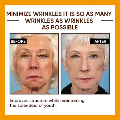 🔥Full refund if no effect after use🔥2026, Exclusive premium Suiiao COMPLEX technology and sophisticated design 2-minute wrinkle-reducing serum