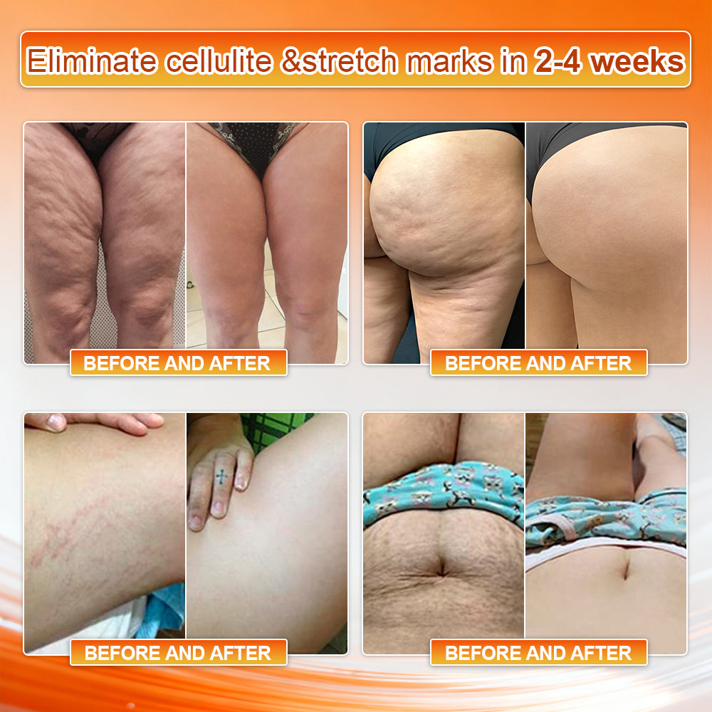 👙𝐎𝐟𝐟𝐢𝐜𝐢𝐚𝐥 𝐁𝐫𝐚𝐧𝐝 𝐒𝐭𝐨𝐫𝐞 | NATRAVOR® 𝟐𝟎𝟐𝟔 𝐌𝐨𝐫𝐢𝐧𝐠𝐚 & 𝐁𝐞𝐫𝐛𝐞𝐫𝐢𝐧𝐞 𝟒-𝐈𝐧-𝟏 𝐌𝐢𝐜𝐫𝐨-𝐏𝐚𝐫𝐭𝐢𝐜𝐥𝐞 𝐒𝐜𝐮𝐥𝐩𝐭𝐢𝐧𝐠 & 𝐅𝐚𝐭-𝐁𝐮𝐫𝐧 𝐒𝐡𝐨𝐫𝐭𝐬
