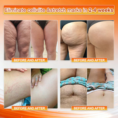 👙𝐎𝐟𝐟𝐢𝐜𝐢𝐚𝐥 𝐁𝐫𝐚𝐧𝐝 𝐒𝐭𝐨𝐫𝐞 | NATRAVOR® 𝟐𝟎𝟐𝟔 𝐌𝐨𝐫𝐢𝐧𝐠𝐚 & 𝐁𝐞𝐫𝐛𝐞𝐫𝐢𝐧𝐞 𝟒-𝐈𝐧-𝟏 𝐌𝐢𝐜𝐫𝐨-𝐏𝐚𝐫𝐭𝐢𝐜𝐥𝐞 𝐒𝐜𝐮𝐥𝐩𝐭𝐢𝐧𝐠 & 𝐅𝐚𝐭-𝐁𝐮𝐫𝐧 𝐒𝐡𝐨𝐫𝐭𝐬