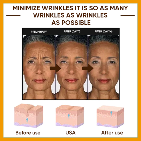 🔥Full refund if no effect after use🔥2026, Exclusive premium Suiiao COMPLEX technology and sophisticated design 2-minute wrinkle-reducing serum