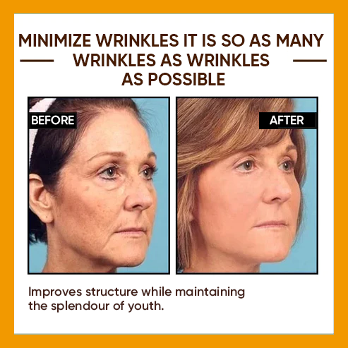 🔥Full refund if no effect after use🔥2026, Exclusive premium Suiiao COMPLEX technology and sophisticated design 2-minute wrinkle-reducing serum