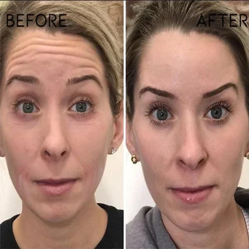 🔥Full refund if no effect after use🔥2026, Exclusive premium Suiiao COMPLEX technology and sophisticated design 2-minute wrinkle-reducing serum