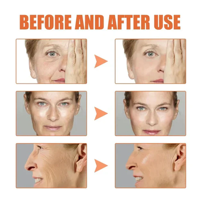 🔥Full refund if no effect after use🔥2026, Exclusive premium Suiiao COMPLEX technology and sophisticated design 2-minute wrinkle-reducing serum