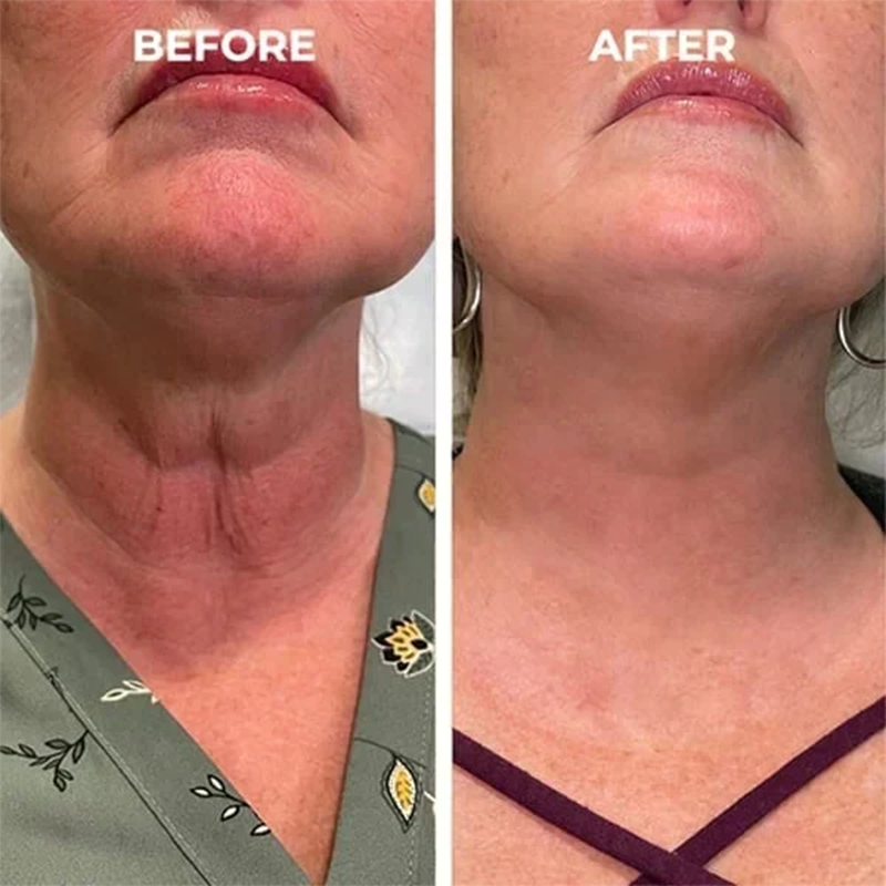 🔥Full refund if no effect after use🔥2026, Exclusive premium Suiiao COMPLEX technology and sophisticated design 2-minute wrinkle-reducing serum