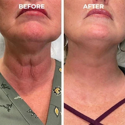 🔥Full refund if no effect after use🔥2026, Exclusive premium Suiiao COMPLEX technology and sophisticated design 2-minute wrinkle-reducing serum