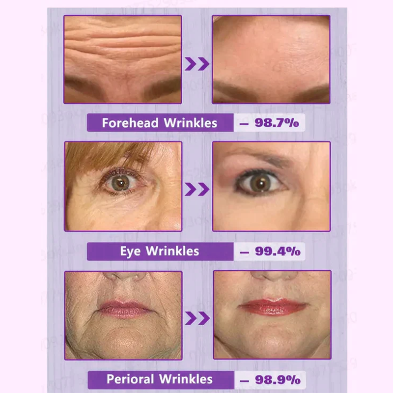 🔥Full refund if no effect after use🔥2026, Exclusive premium Suiiao COMPLEX technology and sophisticated design 2-minute wrinkle-reducing serum