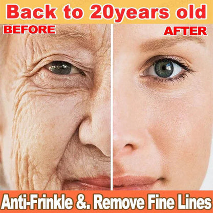 🔥Full refund if no effect after use🔥2026, Exclusive premium Suiiao COMPLEX technology and sophisticated design 2-minute wrinkle-reducing serum